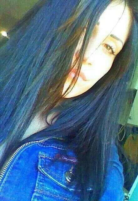 Альбина